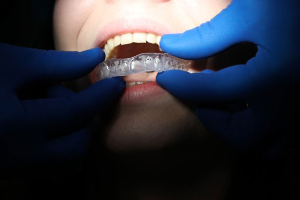 Profilaksa zuba i mekih tkiva 1