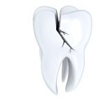 Stomatološki pregled deteta sa traumatskom povredom zuba 8